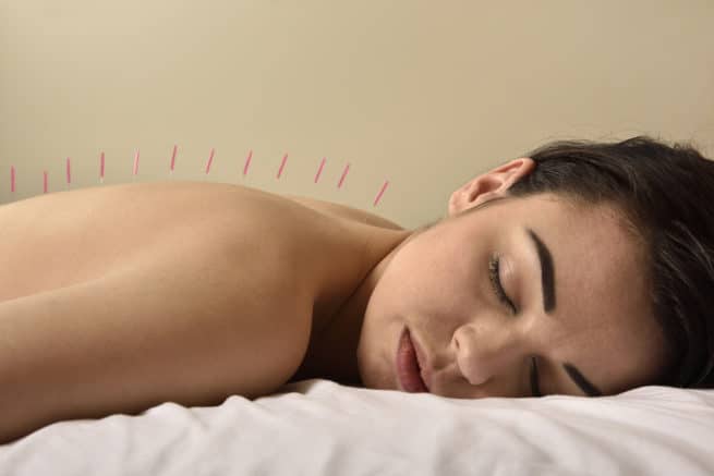 Acupuntura Clínica fuensalud