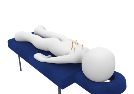 PUNCION SECA en Clínica Fuensalud