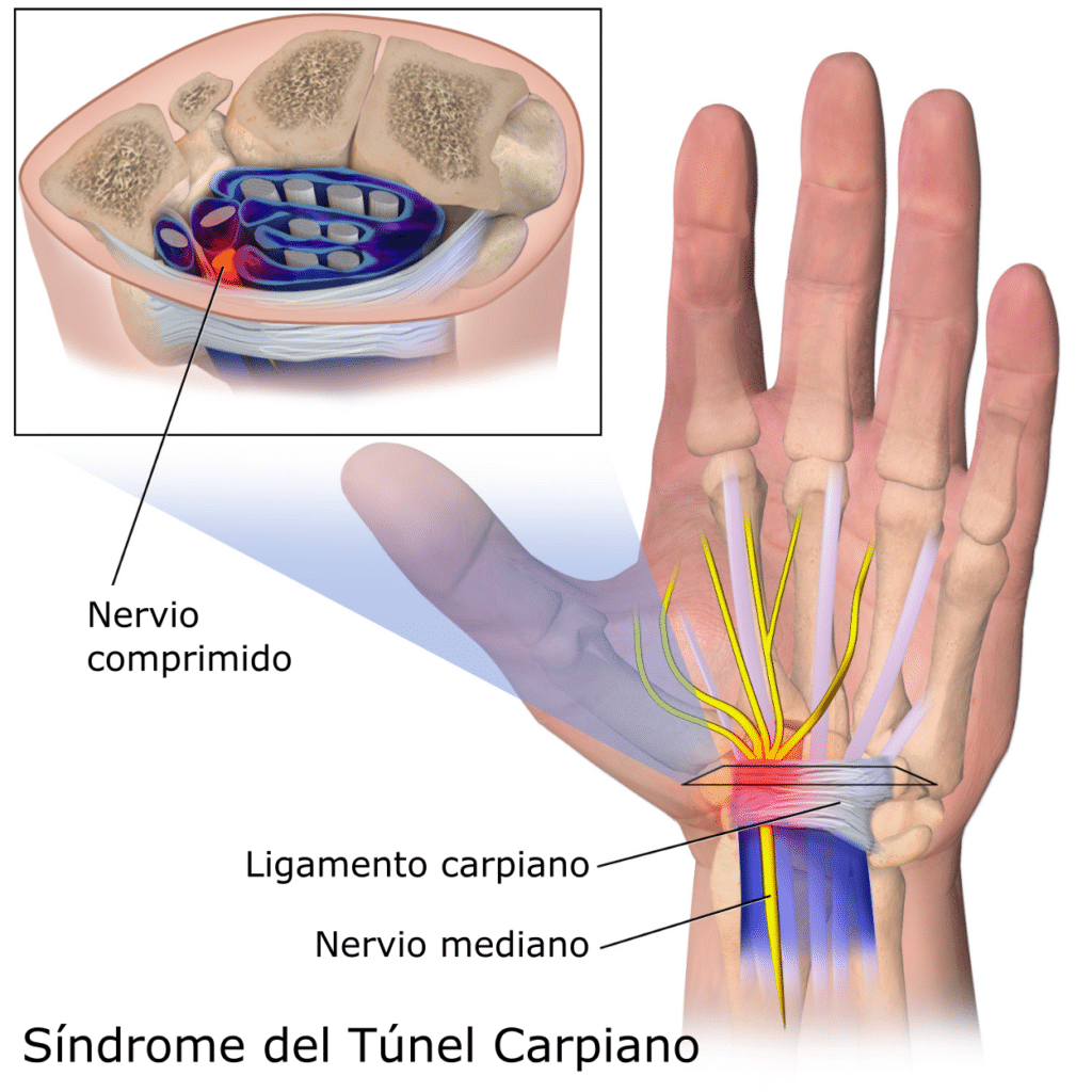 Canal del Túnel Carpiano