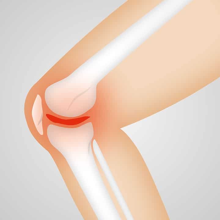 lesiones deportivas dolor rodilla