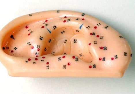 Auriculoterapia por Clínica Fuensalud