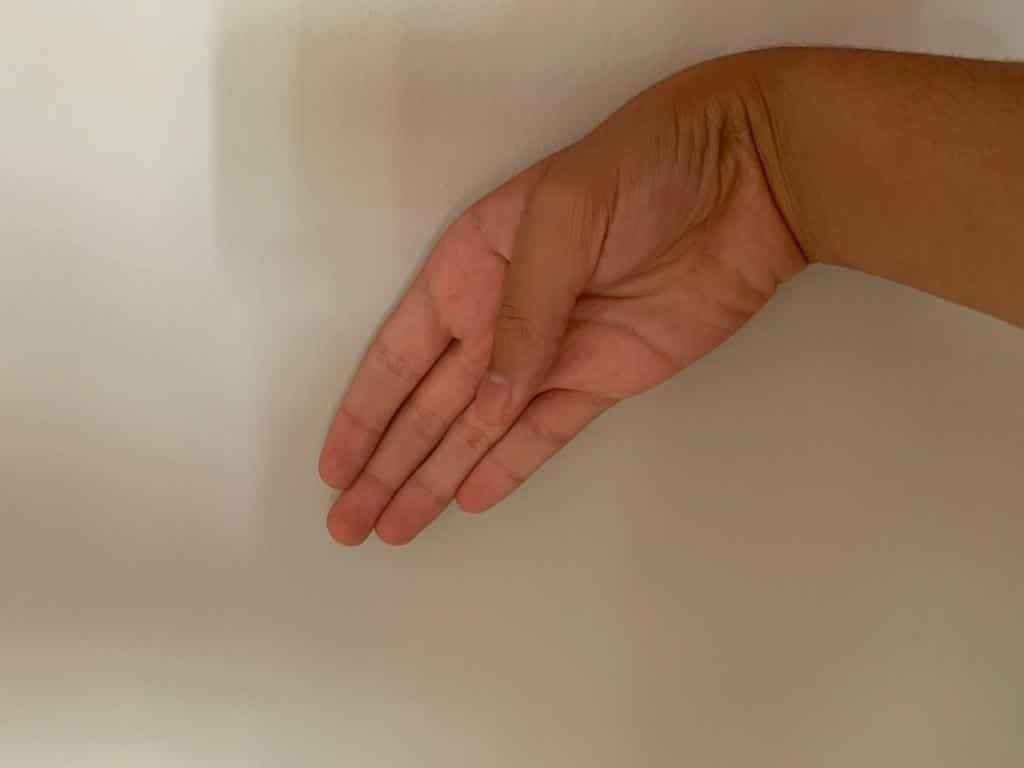Test de Finkelstein 2 Clínica Fuensalud Quervain