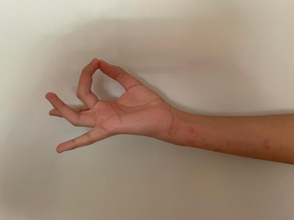 ejercicio 1 Clínica Fuensalud Quervain