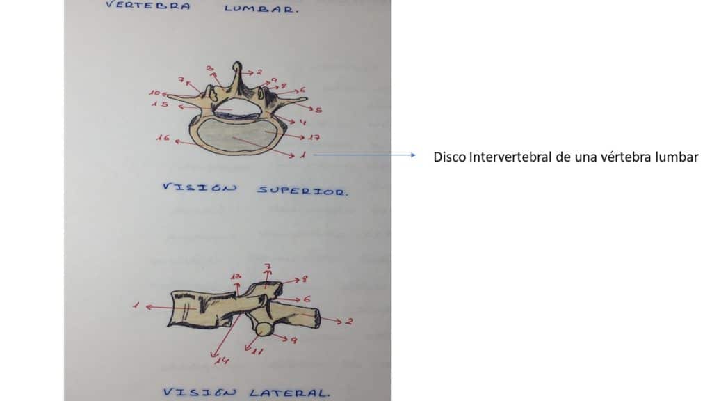 Disco lumbar