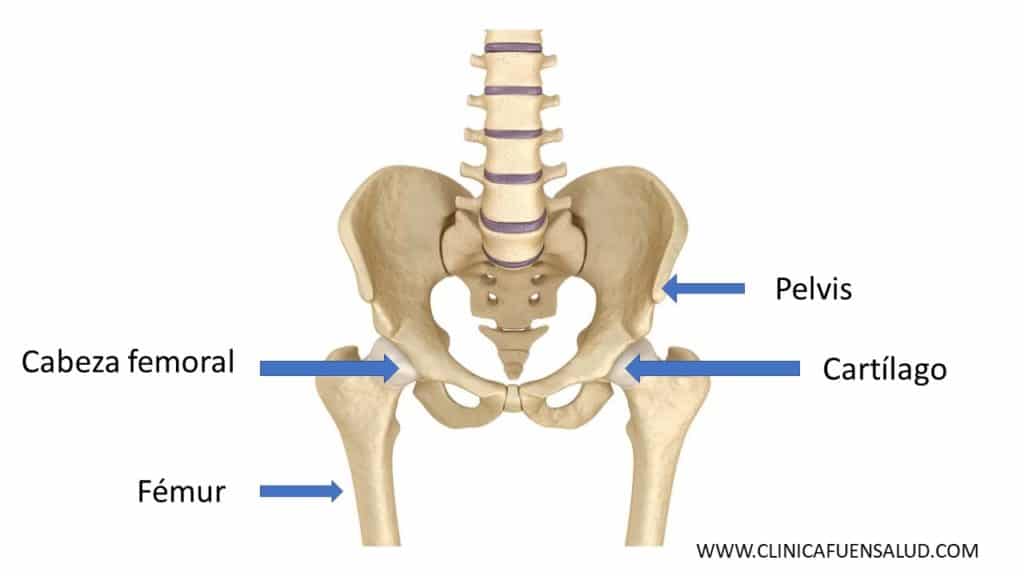Artrosis de cadera y siete consejos a seguir