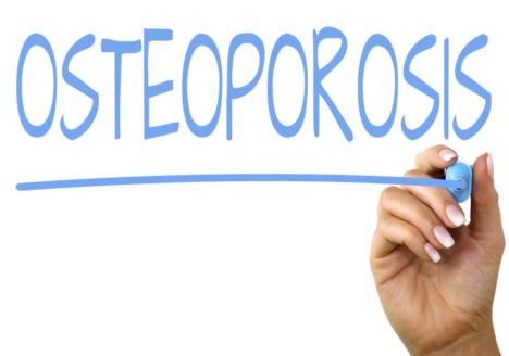 OSTEOPOROSIS Clínica Fuensalud