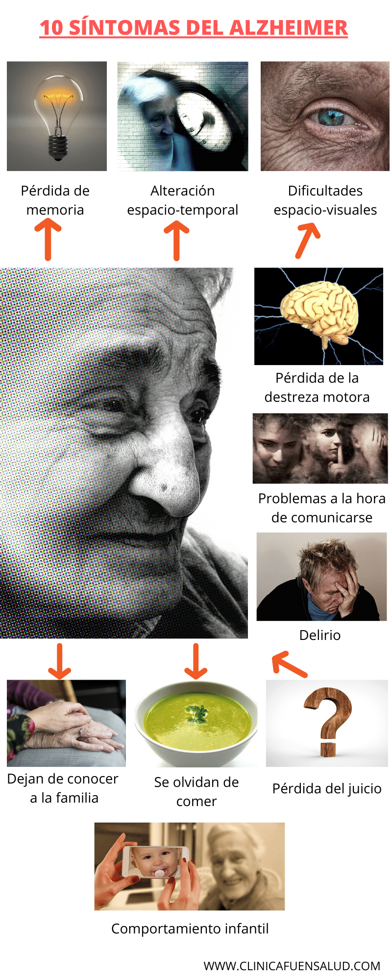Infografía Alzheimer
