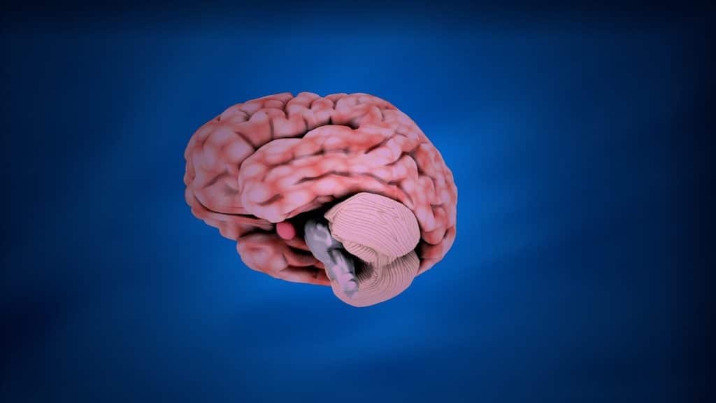 cerebro con Alzheimer