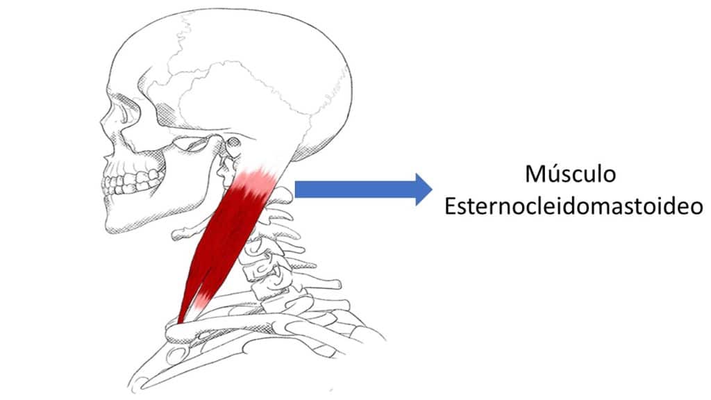 Músculo Esternocleidomastoideo por Clínica Fuensalud