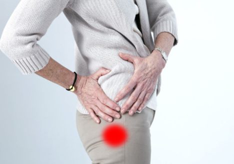 Trocanteritis por Clínica Fuensalud