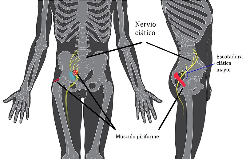 Nervio Ciático por Clínica Fuensalud