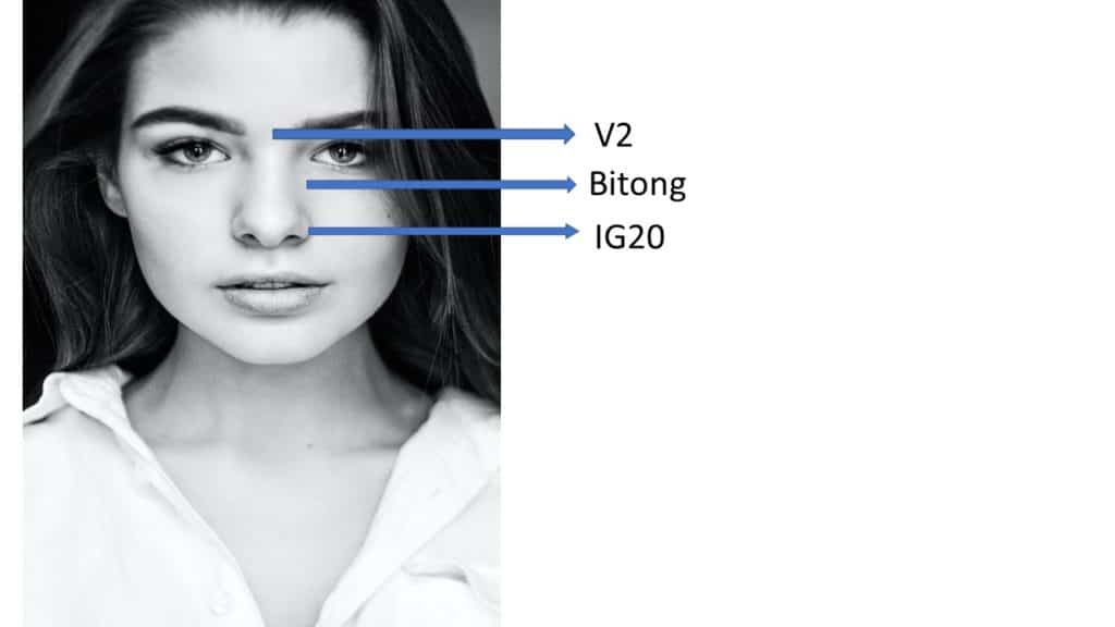 Puntos de Acupuntura para Sinusitis por Clínica Fuensalud