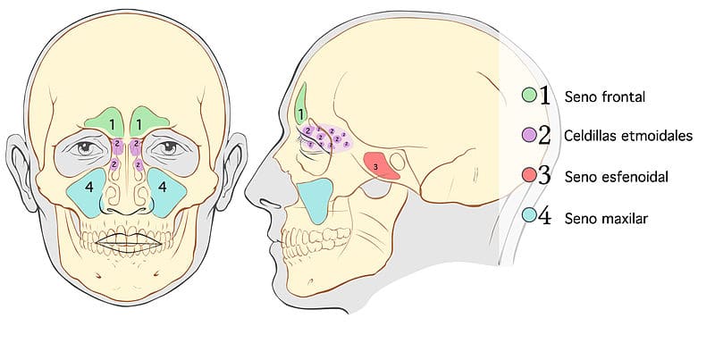 Sinusitis por Senos paranasales