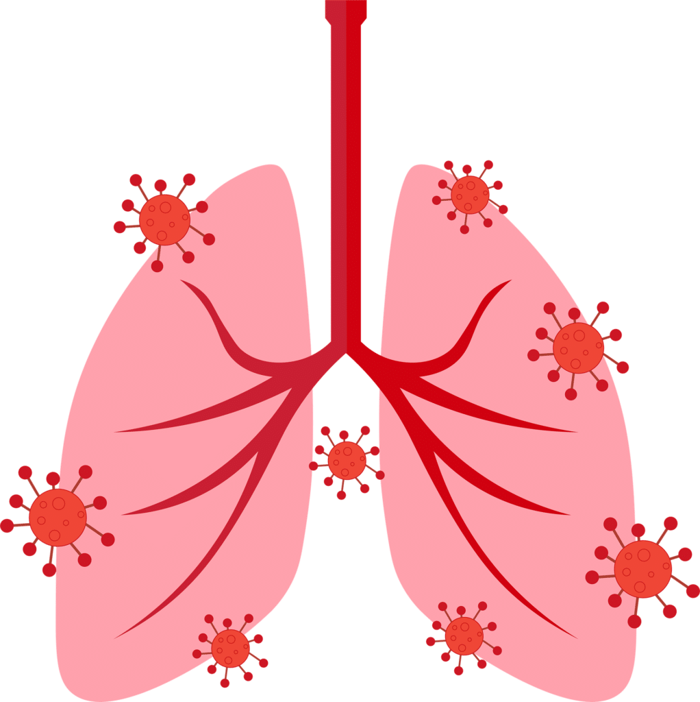 Pulmones y secuelas del Covid-19 por Clínica Fuensalud