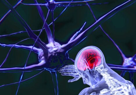 Logopedia en esclerosis múltiple por Clínica Fuensalud