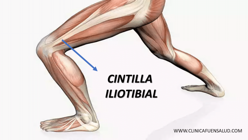 Cintilla Iliotibial por Clínica Fuensalud