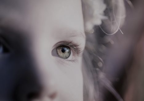 Parálisis Cerebral tratada por Logopeda de Clínica Fuensalud