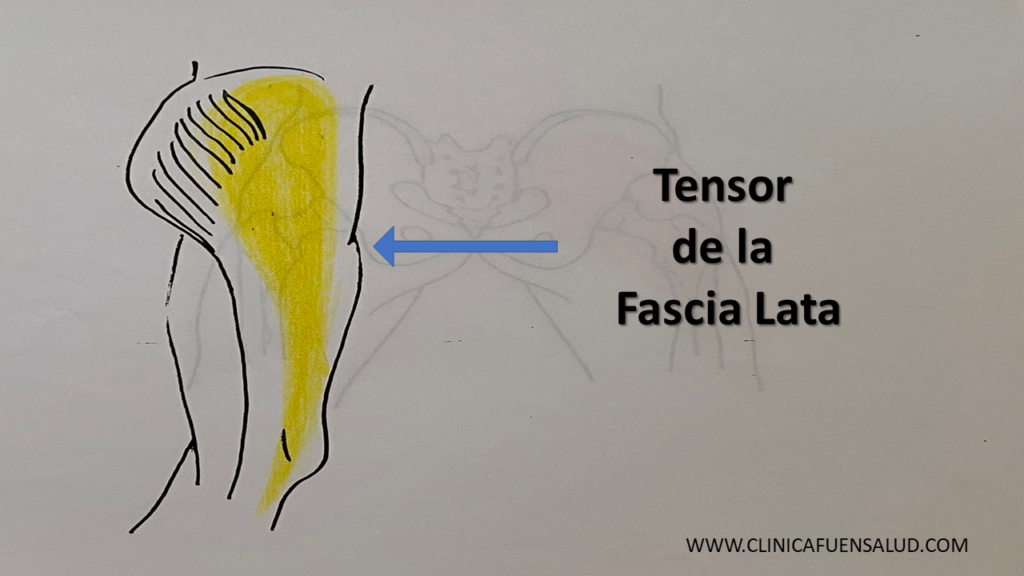 Tensor de la Fascia Lata de Clínica Fuensalud