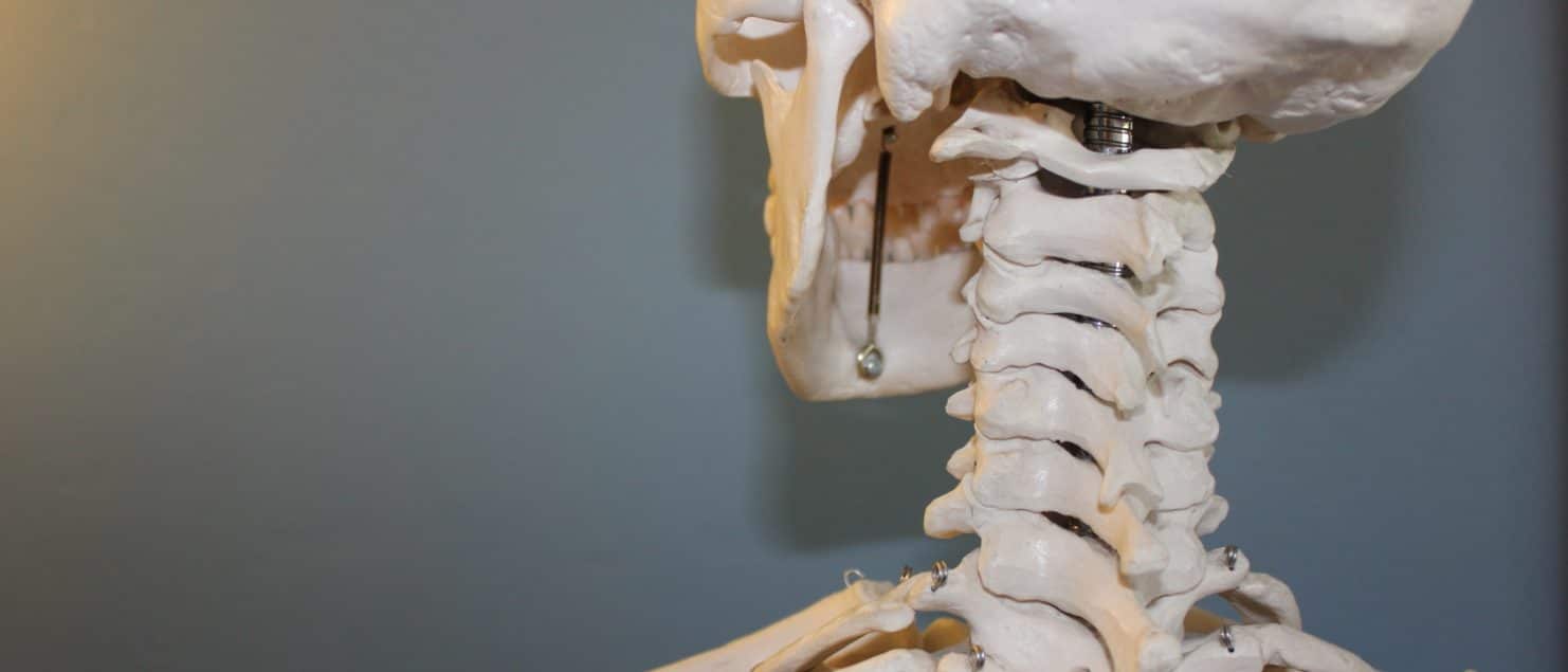 Artrosis Cervical y la Fisioterapia de Clínica Fuensalud