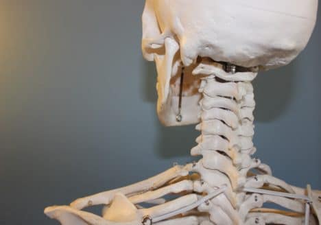 Artrosis Cervical y la Fisioterapia de Clínica Fuensalud