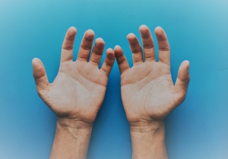 enfermedad de Dupuytren