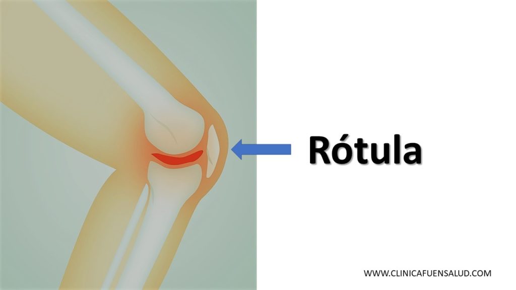 Rótula de Clínica Fuensalud