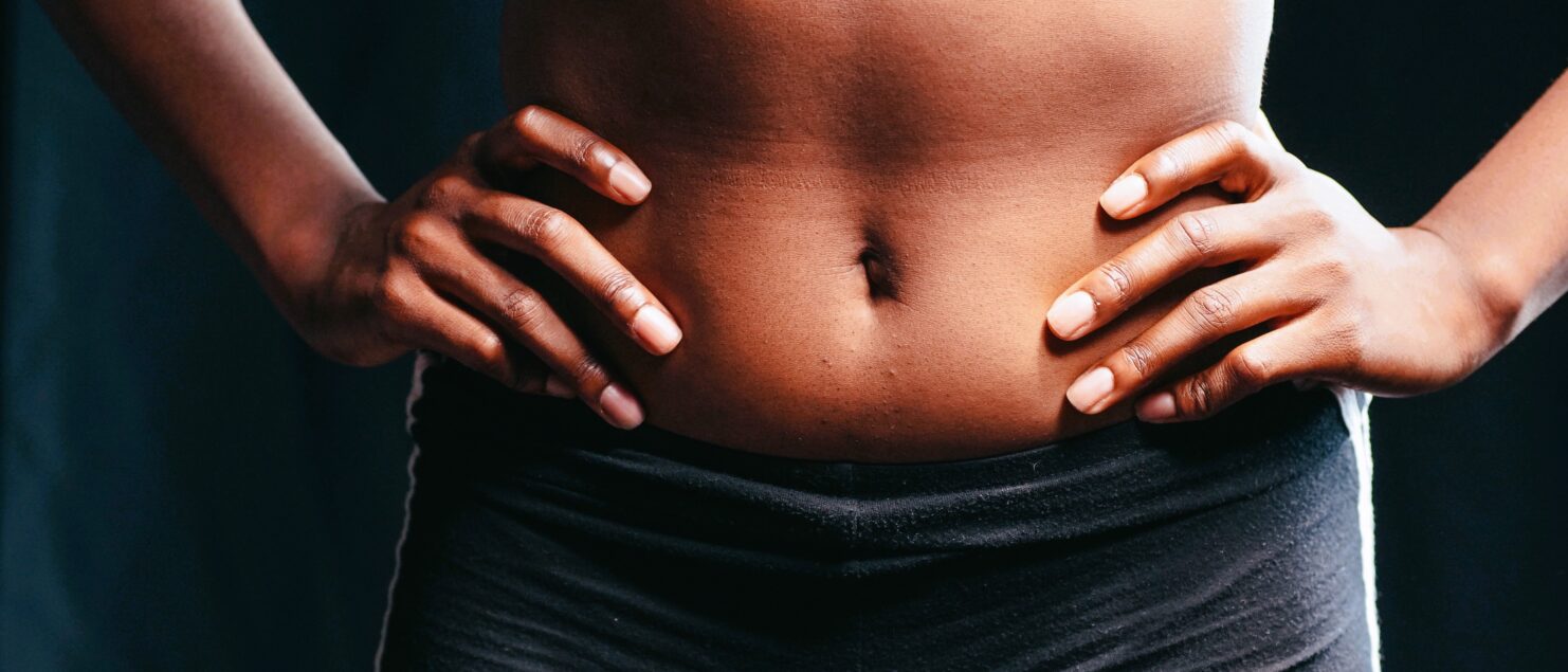 Diástasis abdominal por Clínica Fuensalud