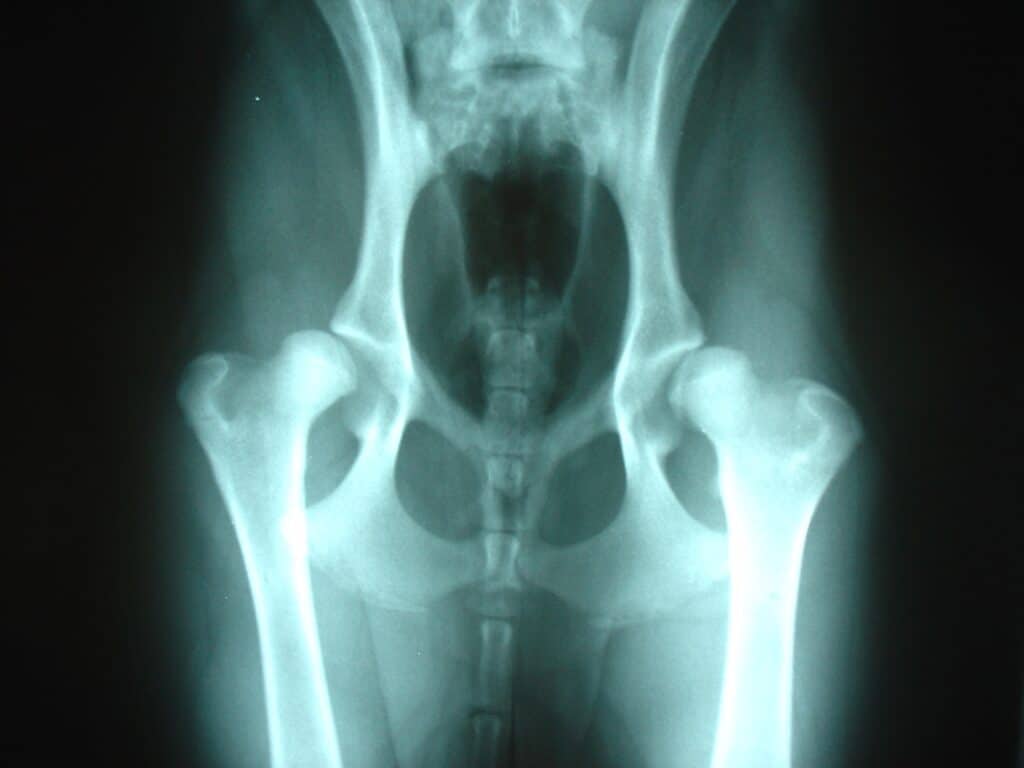 Radiografía de pelvis por Clínica Fuensalud