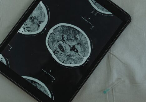 Rehabilitación a domicilio para el ICTUS por Clínica Fuensalud